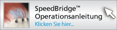 Speedbridge Operationsanleitung